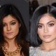 Lip Fillers