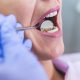 10 Reasons You Might Suffer from Severe Toothache